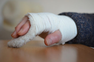 Warum die Gliedertaxe so entscheidend ist